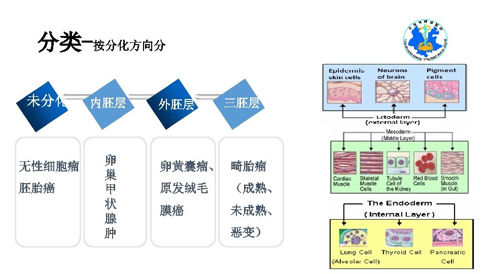 分类-按分化方向分 未分化 无性细胞瘤 胚胎癌 内胚层 卵 巢 甲 状 腺 肿 外胚层 三胚层 卵黄囊瘤、