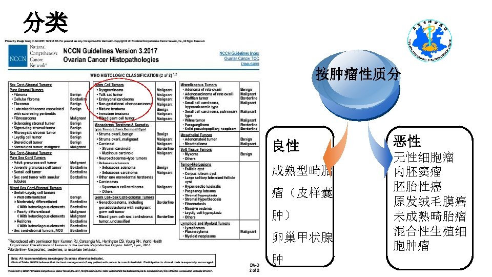 分类 按肿瘤性质分 良性 成熟型畸胎 瘤（皮样囊 肿） 卵巢甲状腺 肿 恶性 无性细胞瘤 内胚窦瘤 胚胎性癌 原发绒毛膜癌 未成熟畸胎瘤