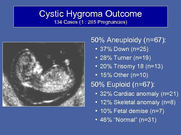Cystic Hygroma Outcome 134 Cases (1 : 285 Pregnancies) 50% Aneuploidy (n=67): • •