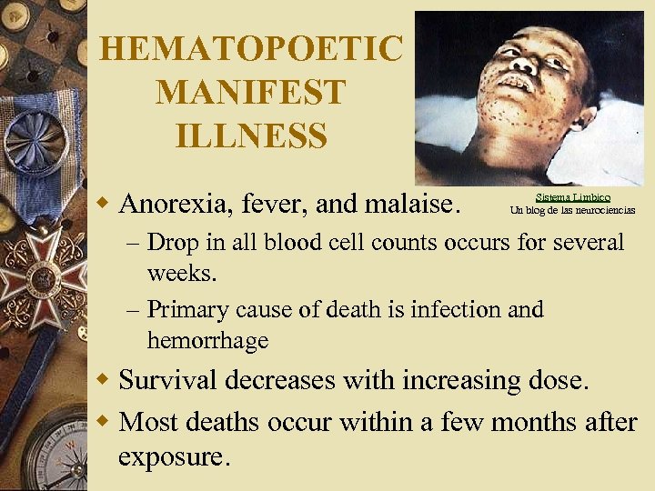 HEMATOPOETIC MANIFEST ILLNESS w Anorexia, fever, and malaise. Sistema Limbico Un blog de las