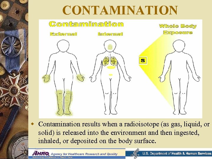 CONTAMINATION w Contamination results when a radioisotope (as gas, liquid, or solid) is released