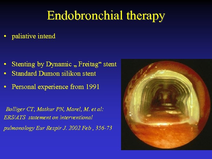 Endobronchial therapy • paliative intend • Stenting by Dynamic „ Freitag“ stent • Standard