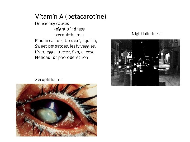 Vitamin A (betacarotine) Deficiency causes -night blindness -xerophthalmia Find in carrots, broccoli, squash, Sweet