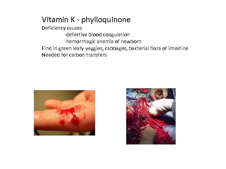 Vitamin K - phylloquinone Deficiency causes -defective blood coagulation -hemorrhagic anemia of newborn Find
