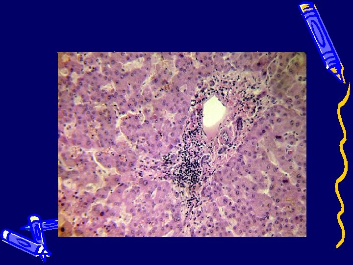 Печень (проявления гепатита) 