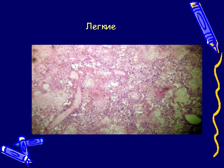 Легкие 