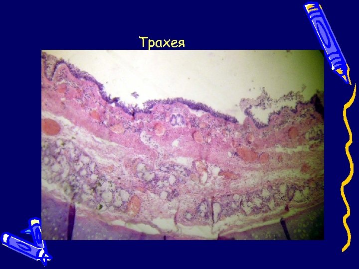 Трахея 