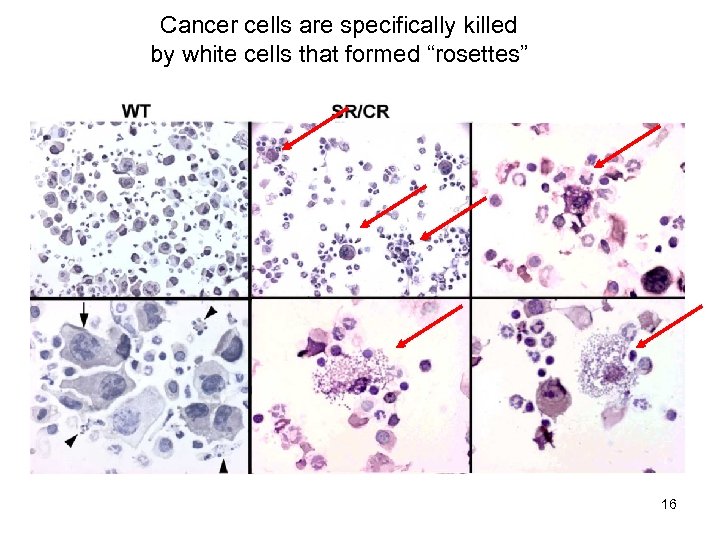 Cancer cells are specifically killed by white cells that formed “rosettes” 16 