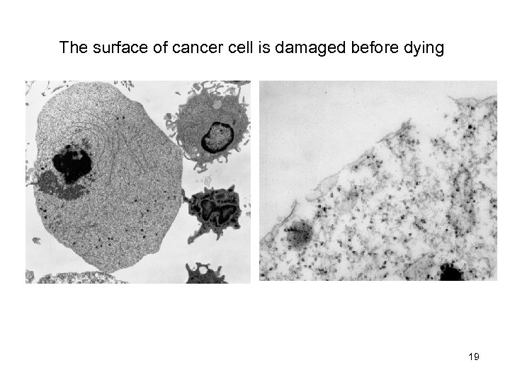 The surface of cancer cell is damaged before dying 19 