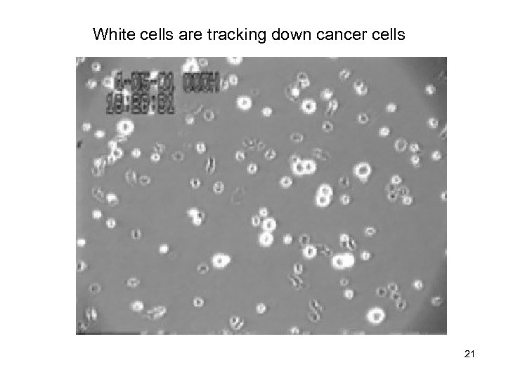 White cells are tracking down cancer cells Cell aggregation 21 