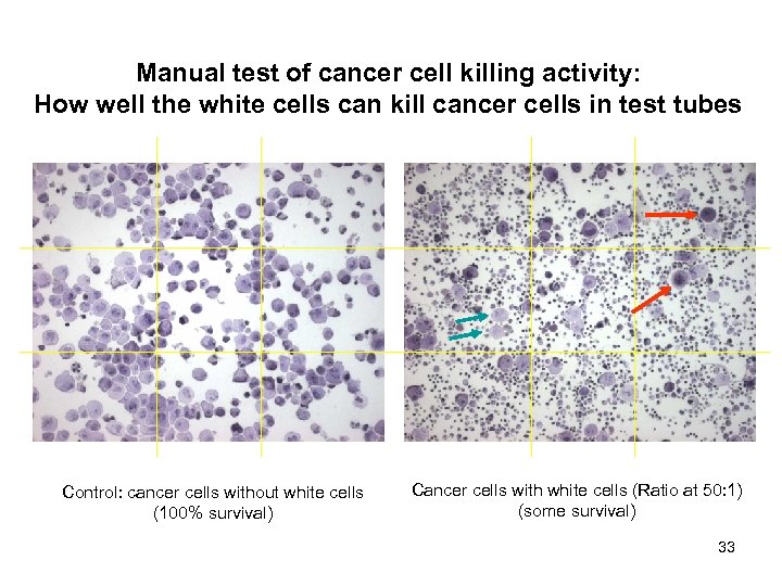 Manual test of cancer cell killing activity: How well the white cells can kill