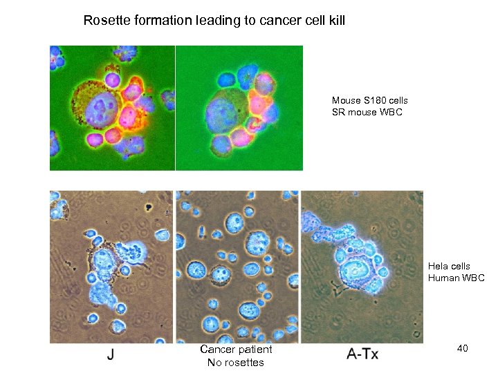 Rosette formation leading to cancer cell kill Mouse S 180 cells SR mouse WBC