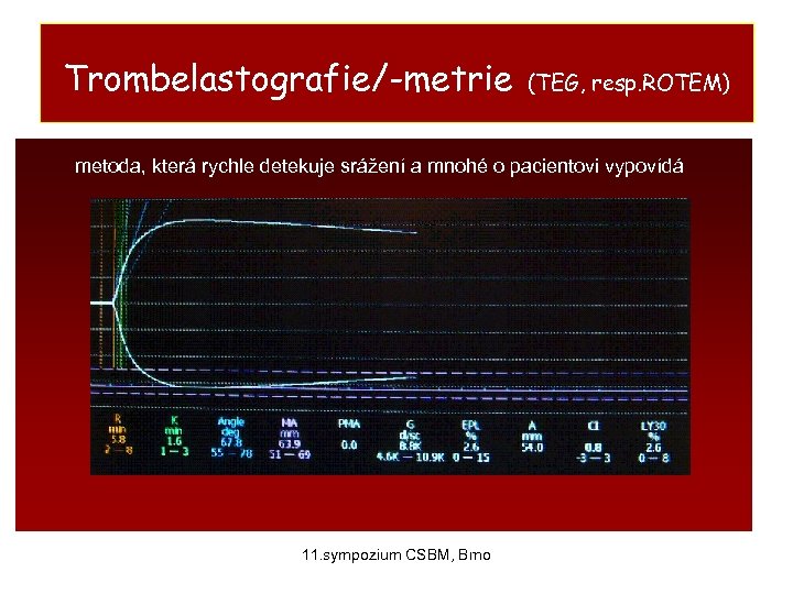 Trombelastografie/-metrie (TEG, resp. ROTEM) metoda, která rychle detekuje srážení a mnohé o pacientovi vypovídá