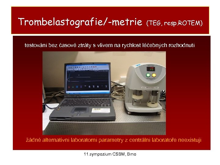 Trombelastografie/-metrie (TEG, resp. ROTEM) testování bez časové ztráty s vlivem na rychlost léčebných rozhodnutí
