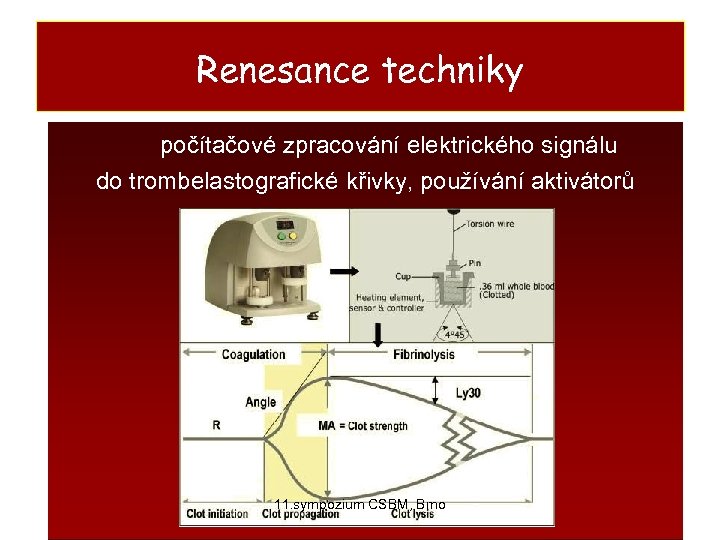 Renesance techniky počítačové zpracování elektrického signálu do trombelastografické křivky, používání aktivátorů 11. sympozium CSBM,