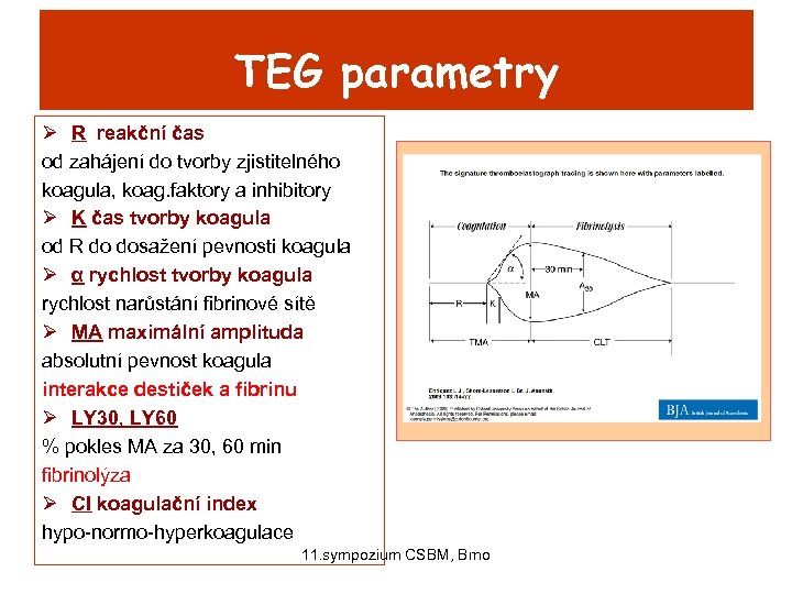 TEG parametry Ø R reakční čas od zahájení do tvorby zjistitelného koagula, koag. faktory