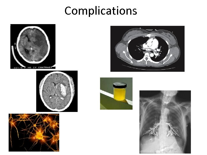 Complications 