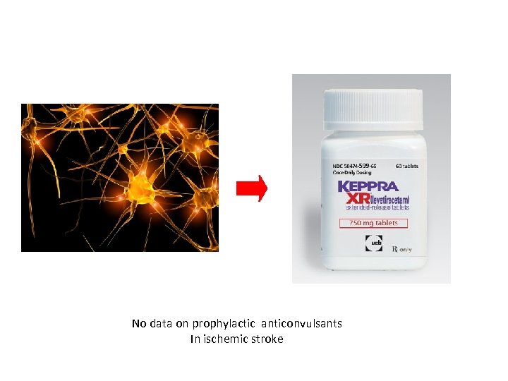 No data on prophylactic anticonvulsants In ischemic stroke 