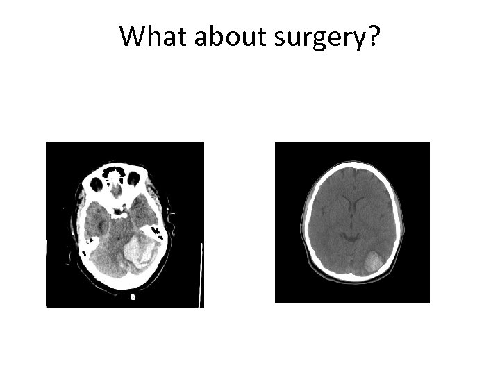 What about surgery? 