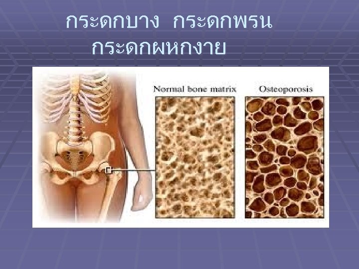 กระดกบาง กระดกพรน กระดกผหกงาย 