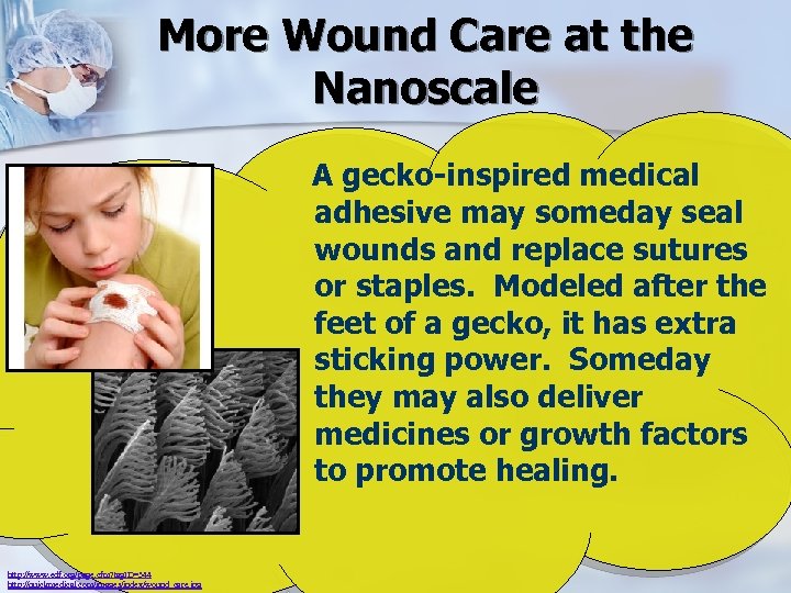 More Wound Care at the Nanoscale A gecko-inspired medical adhesive may someday seal wounds