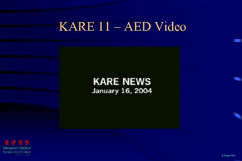 KARE 11 – AED Video R. Fischer-2005 