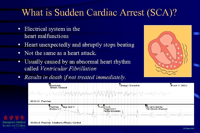 What is Sudden Cardiac Arrest (SCA)? Electrical system in the heart malfunctions Heart unexpectedly