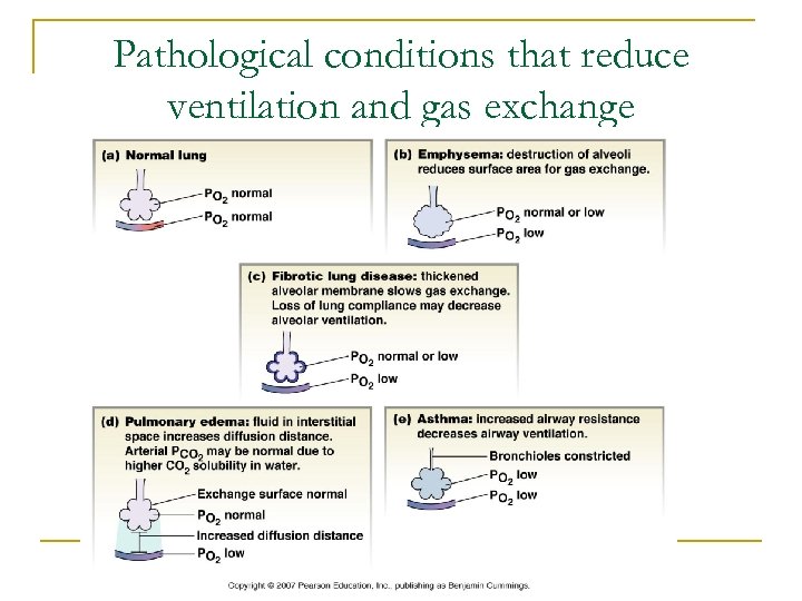 Pathological conditions that reduce ventilation and gas exchange 