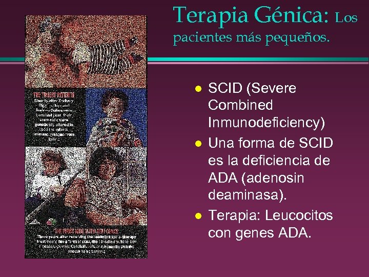 Terapia Génica: Los pacientes más pequeños. l l l SCID (Severe Combined Inmunodeficiency) Una