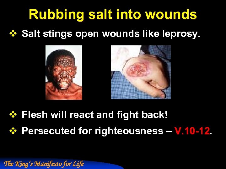 Rubbing salt into wounds v Salt stings open wounds like leprosy. v Flesh will