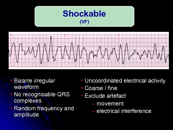 Shockable (VF) • Bizarre irregular waveform • No recognisable QRS complexes • Random frequency