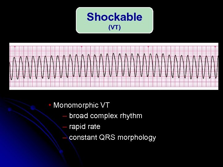 Shockable (VT) • Monomorphic VT – broad complex rhythm – rapid rate – constant