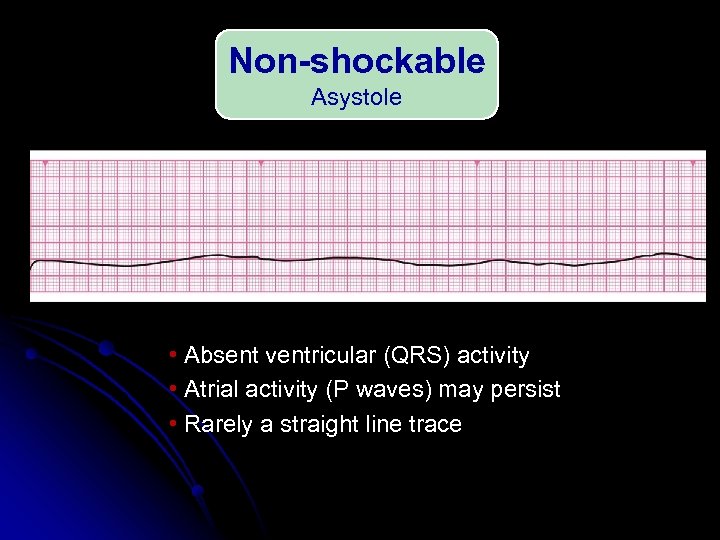 Non-shockable Asystole • Absent ventricular (QRS) activity • Atrial activity (P waves) may persist