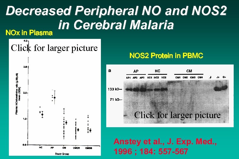 Decreased Peripheral NO and NOS 2 in Cerebral Malaria NOx in Plasma Click for