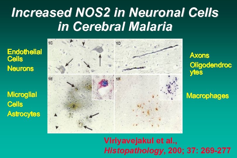 Increased NOS 2 in Neuronal Cells in Cerebral Malaria Endothelial Cells Neurons Microglial Cells