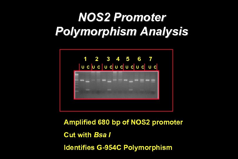 NOS 2 Promoter Polymorphism Analysis 1 2 U C 3 4 5 6 U