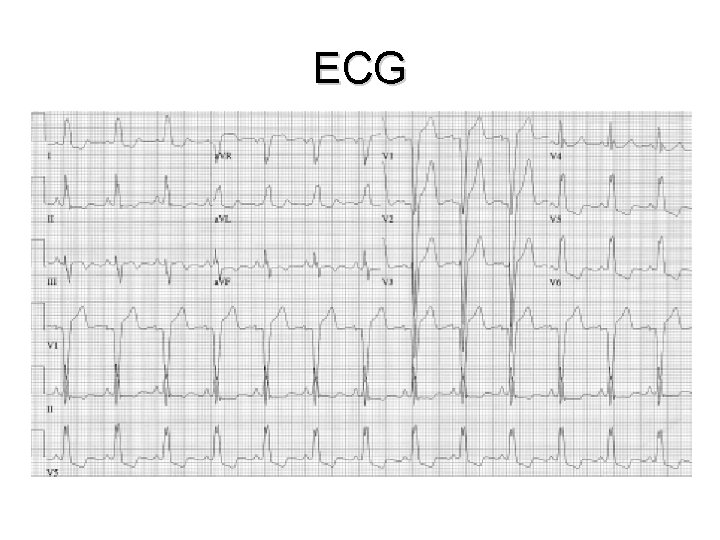 ECG Case Studies Moosa Kalla Case 1