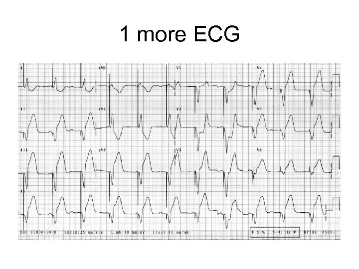 ECG Case Studies Moosa Kalla Case 1