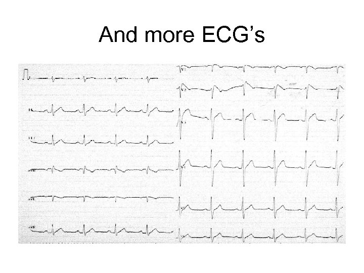 And more ECG’s 