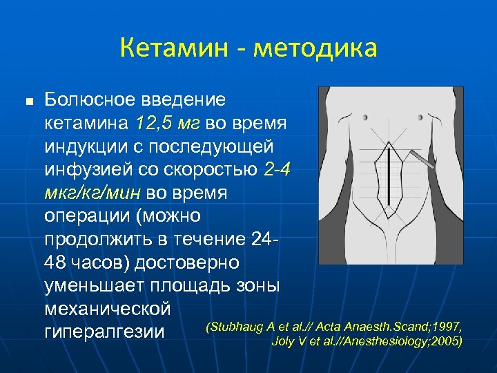 Кетамин - методика n Болюсное введение кетамина 12, 5 мг во время индукции с
