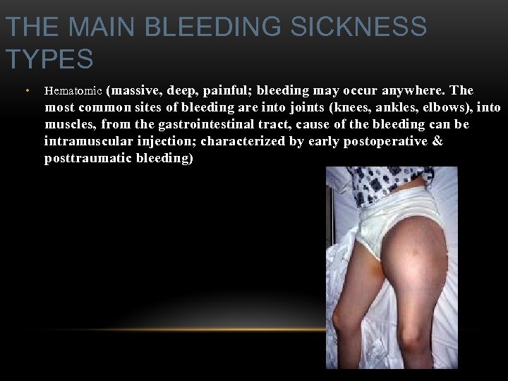 THE MAIN BLEEDING SICKNESS TYPES • Hematomic (massive, deep, painful; bleeding may occur anywhere.