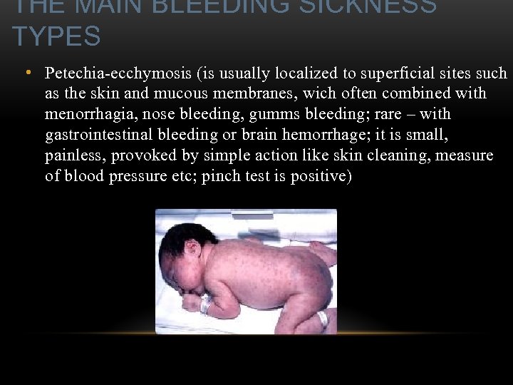 THE MAIN BLEEDING SICKNESS TYPES • Petechia-ecchymosis (is usually localized to superficial sites such