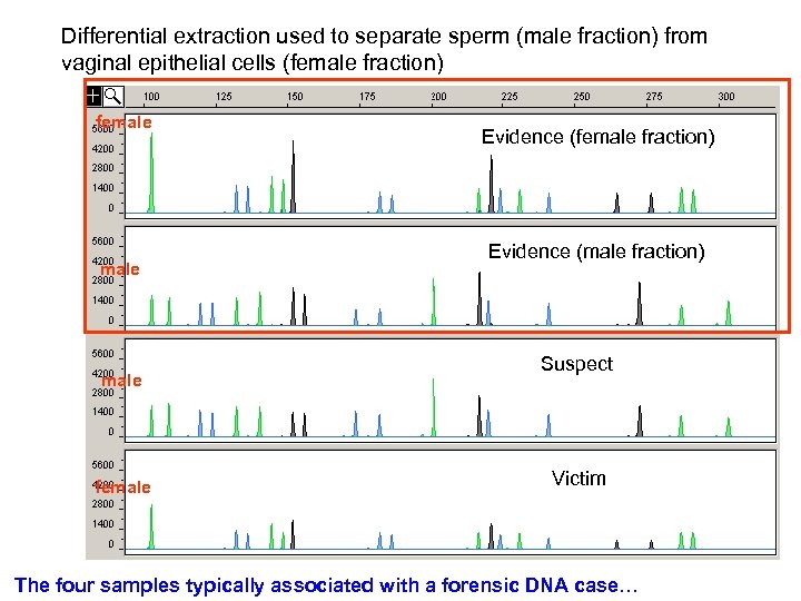 Differential extraction used to separate sperm (male fraction) from vaginal epithelial cells (female fraction)
