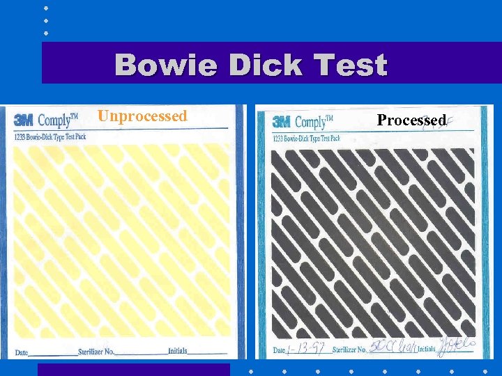 Bowie Dick Test Unprocessed Processed 