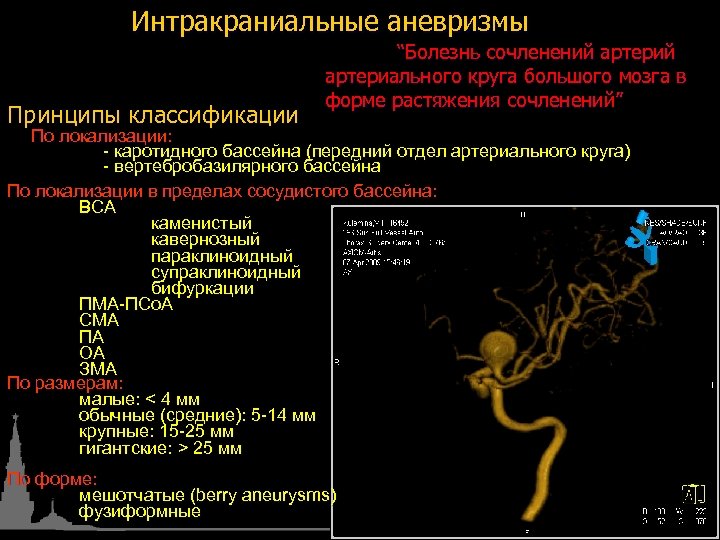 Интракраниальные аневризмы Принципы классификации “Болезнь сочленений артериального круга большого мозга в форме растяжения сочленений”