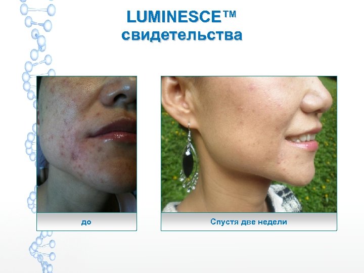 LUMINESCE™ свидетельства до Спустя две недели 