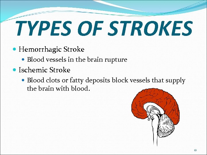 TYPES OF STROKES Hemorrhagic Stroke Blood vessels in the brain rupture Ischemic Stroke Blood