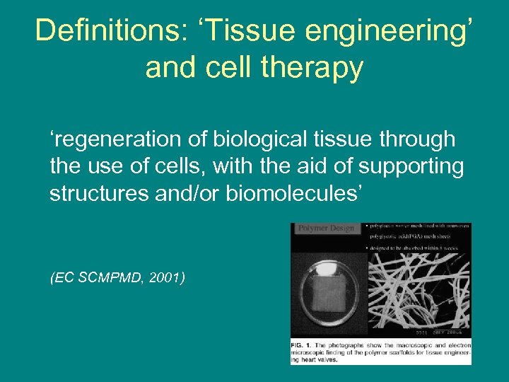 Definitions: ‘Tissue engineering’ and cell therapy ‘regeneration of biological tissue through the use of