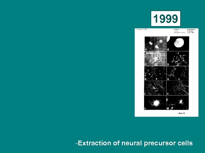 1999 -Extraction of neural precursor cells 