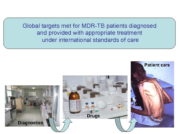 Global targets met for MDR-TB patients diagnosed and provided with appropriate treatment under international